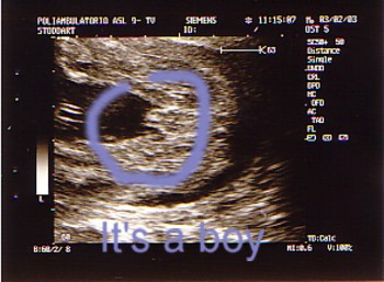 my scan 02/12/2002
